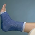 Soft Cast_ankle_16