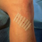 Steri-Strip_Product_04