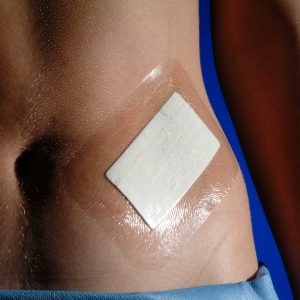 Tegaderm + Pad - Afbeelding 3