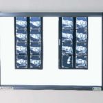 negatoscoopdubbel02.081