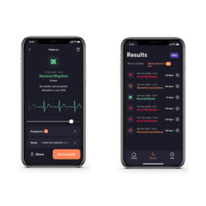Cardionica 1-kanaals EKG - Afbeelding 4